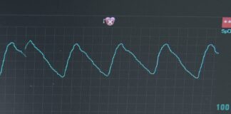 Battipaglia. Ospedale. Patella: al via il cablaggio del reparto di medicina (video)