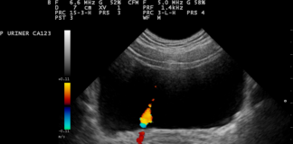 Salerno. Tumore alla prostata, primo corso interattivo di ecografia e risonanza magnetica
